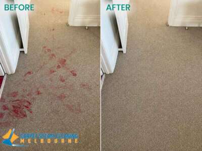 Stain Removal Stain Removal